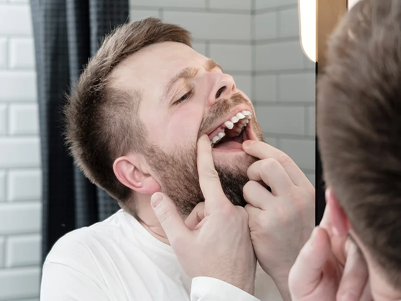 dientes ausentes dentistas en pacifico